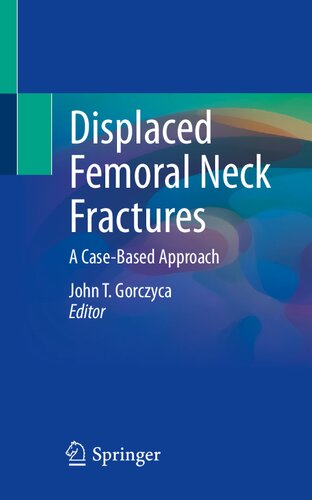 Displaced Femoral Neck Fractures: A Case-Based Approach 2021