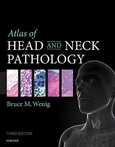 Atlas of Head and Neck Pathology 2015