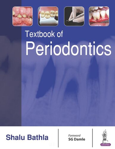 Textbook of Periodontics 2017