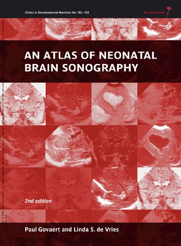 An Atlas of Neonatal Brain Sonography 2010