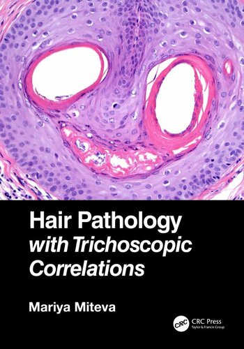 Hair Pathology with Trichoscopic Correlations 2021