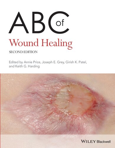 ABC of Wound Healing 2022