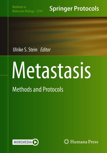 Metastasis: Methods and Protocols 2021