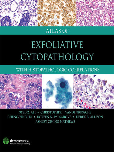 Atlas of Exfoliative Cytopathology: With Histopathologic Correlations 2017