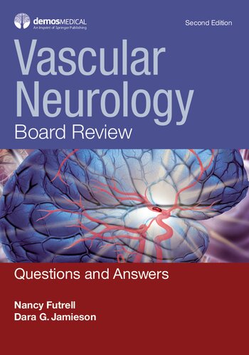 Vascular Neurology Board Review: Questions and Answers 2018