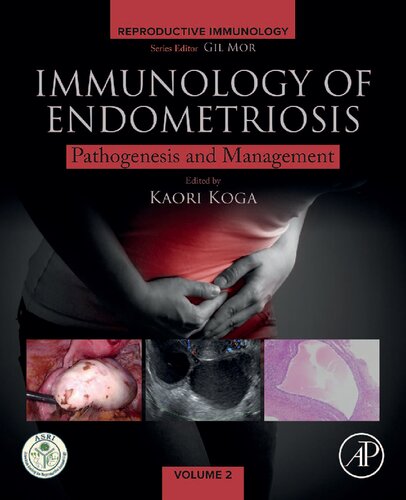 Immunology of Endometriosis: Pathogenesis and Management 2021