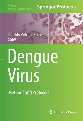 Dengue Virus: Methods and Protocols 2021
