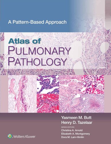 Atlas of Pulmonary Pathology: A Pattern Based Approach 2021