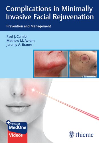 Complications in Minimally Invasive Facial Rejuvenation: Prevention and Management 2020