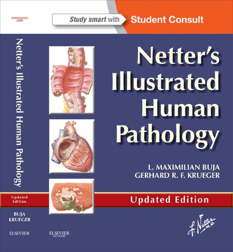 Netter's Illustrated Human Pathology 2013