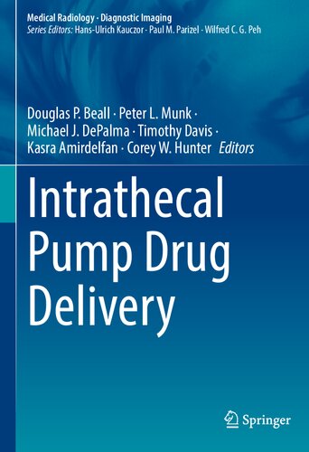 Intrathecal Pump Drug Delivery 2022