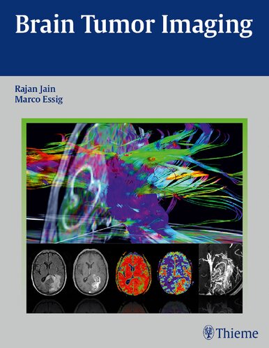 Brain Tumor Imaging 2015