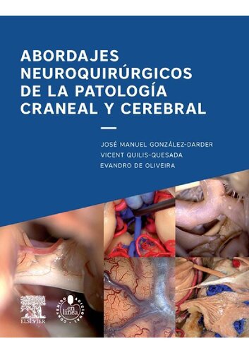 Abordajes neuroquirúrgicos de la patología craneal y cerebral 2015