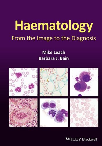 Haematology: From the Image to the Diagnosis 2021
