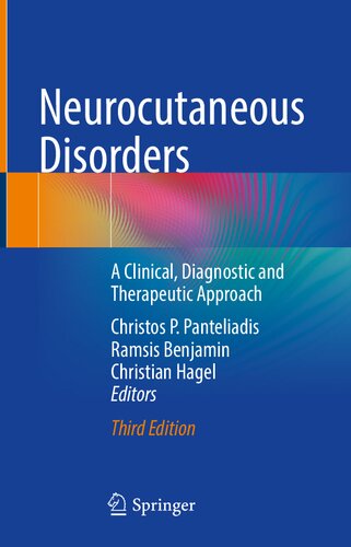 Neurocutaneous Disorders: A Clinical, Diagnostic and Therapeutic Approach 2022