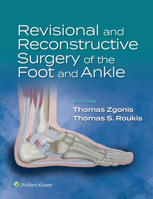 Revisional and Reconstructive Surgery of the Foot and Ankle 2022