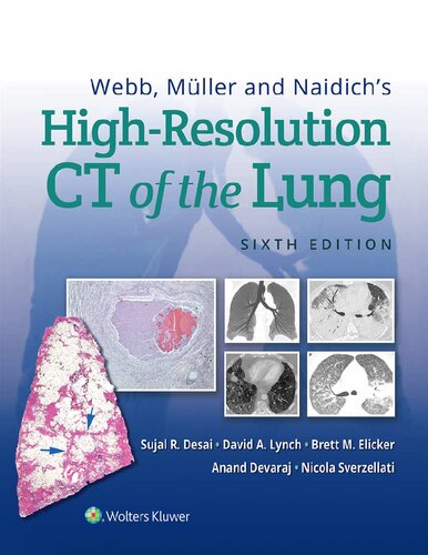 Webb, Müller and Naidich's High-Resolution CT of the Lung 2021