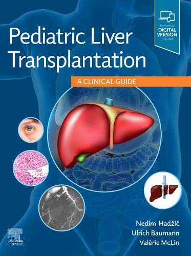 Pediatric Liver Transplantation: A Clinical Guide 2020