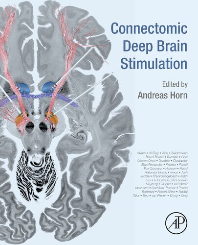 Connectomic Deep Brain Stimulation 2021