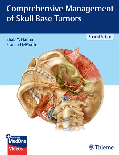 Comprehensive Management of Skull Base Tumors 2021