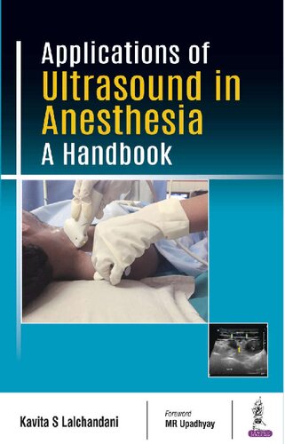 Applications of Ultrasound in Anesthesia: A Handbook 2018