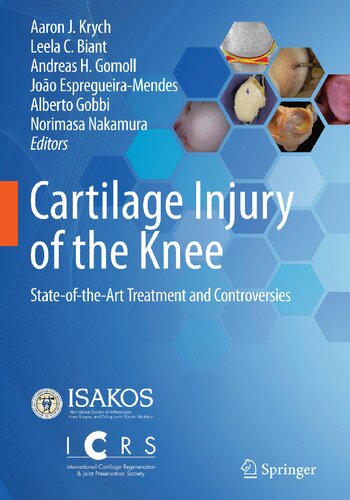 Cartilage Injury of the Knee: State-of-the-Art Treatment and Controversies 2021