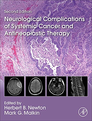 Neurological Complications of Systemic Cancer and Antineoplastic Therapy 2022