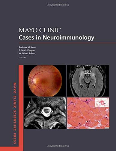 موارد کلینیک مایو در نورایمونولوژی