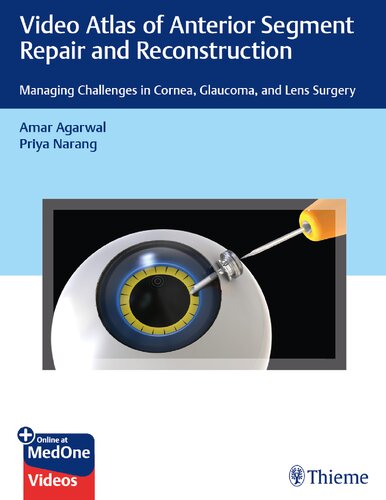 Video Atlas of Anterior Segment Repair and Reconstruction: Managing Challenges in Cornea, Glaucoma, and Lens Surgery 2019