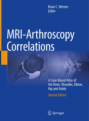 همبستگی آرتروسکوپی MRI: اطلس زانو، شانه، آرنج، لگن و مچ پا بر اساس مورد