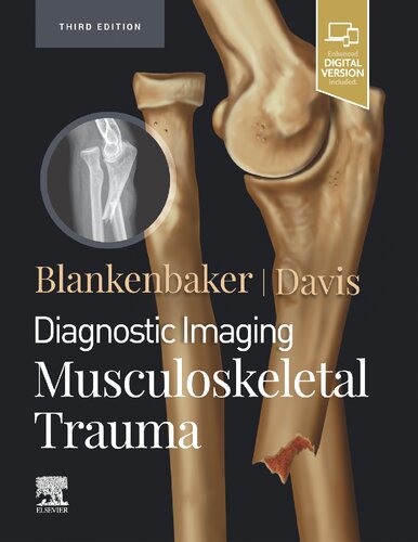 Diagnostic Imaging: Musculoskeletal Trauma 2021