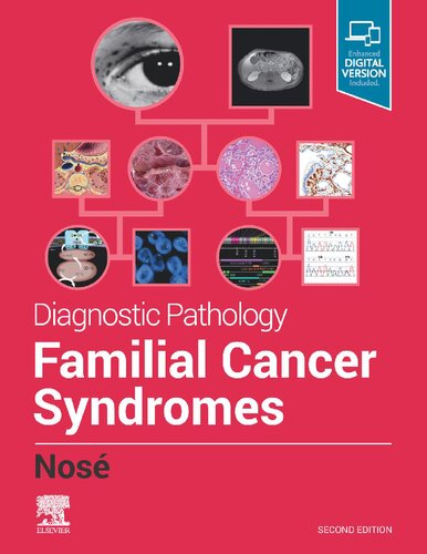 Diagnostic Pathology: Familial Cancer Syndromes 2020