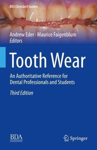 Tooth Wear: An Authoritative Reference for Dental Professionals and Students 2022