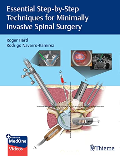 Essential Step-By-Step Techniques for Minimally Invasive Spinal Surgery 2022