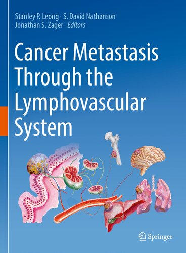 Cancer Metastasis Through the Lymphovascular System 2022