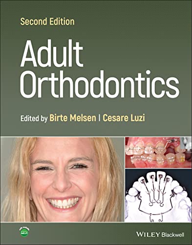 Adult Orthodontics 2022