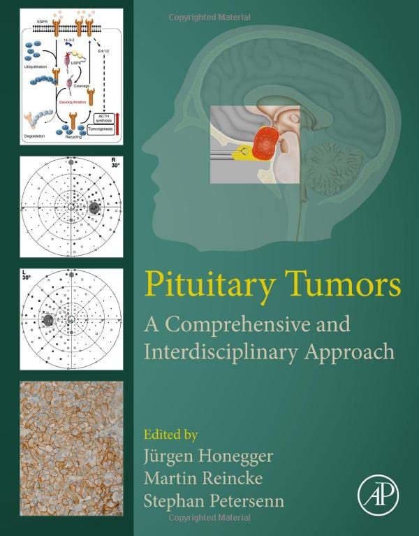 Pituitary Tumors: A Comprehensive and Interdisciplinary Approach 2021