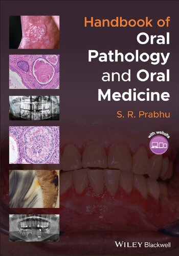 Handbook of Oral Pathology and Oral Medicine 2021