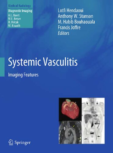 Systemic Vasculitis: Imaging Features 2011