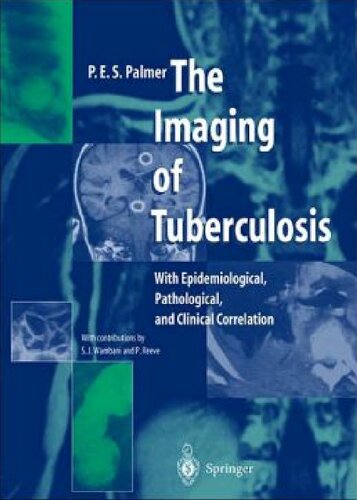 The Imaging of Tuberculosis: With Epidemiological, Pathological, and Clinical Correlation 2012