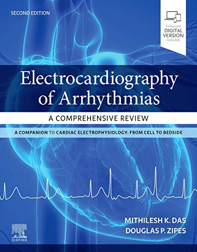 Electrocardiography of Arrhythmias: A Comprehensive Review 2021
