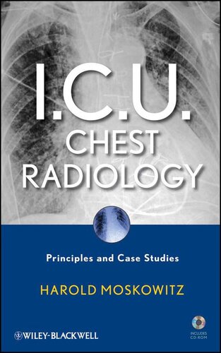 رادیولوژی قفسه سینه ICU: اصول و مطالعات موردی