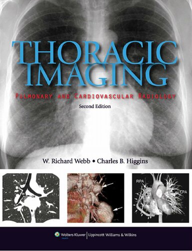 Thoracic Imaging: Pulmonary and Cardiovascular Radiology 2010