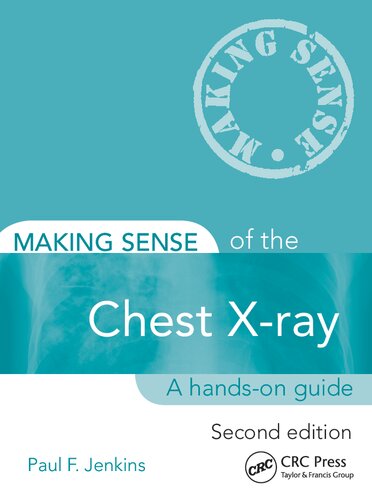 Making Sense of the Chest X-ray, Second Edition: A hands-on guide 2013