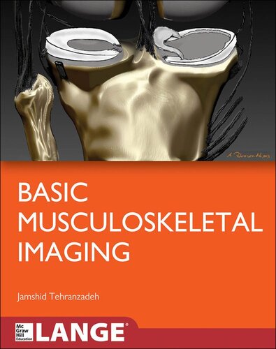 Basic Musculoskeletal Imaging 2013