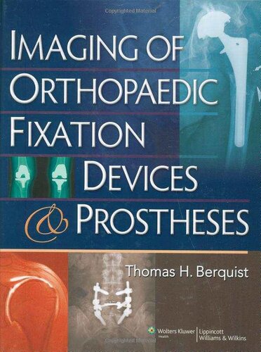 Imaging of Orthopaedic Fixation Devices and Prostheses 2009