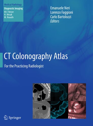 CT Colonography Atlas: For the Practicing Radiologist 2013