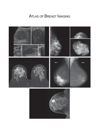 Atlas of Breast Imaging 2012