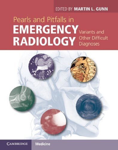 Pearls and Pitfalls in Emergency Radiology: Variants and Other Difficult Diagnoses 2013