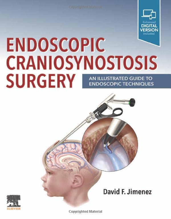 Endoscopic Craniosynostosis Surgery: An Illustrated Guide to Endoscopic Techniques 2022